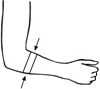 Picture of One-Size Elbow (MR8820)