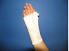 Picture of Long wrist orthosis with palm metal strip (C180)