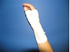 Long wrist orthosis with palm metal strip (C180) attēls